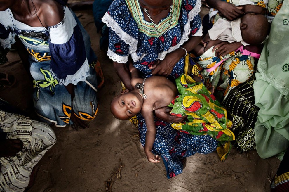 Продовольственный кризис в Нигере nigerfoodcrisis01 990x657 Продовольственный кризис в Нигере