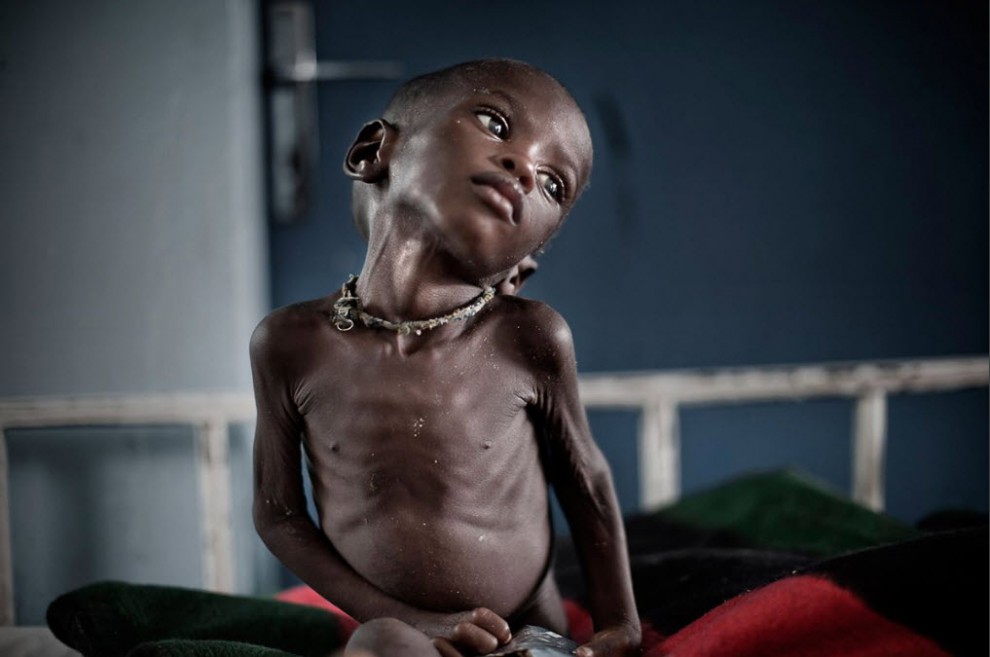 Продовольственный кризис в Нигере nigerfoodcrisis02 990x657 Продовольственный кризис в Нигере
