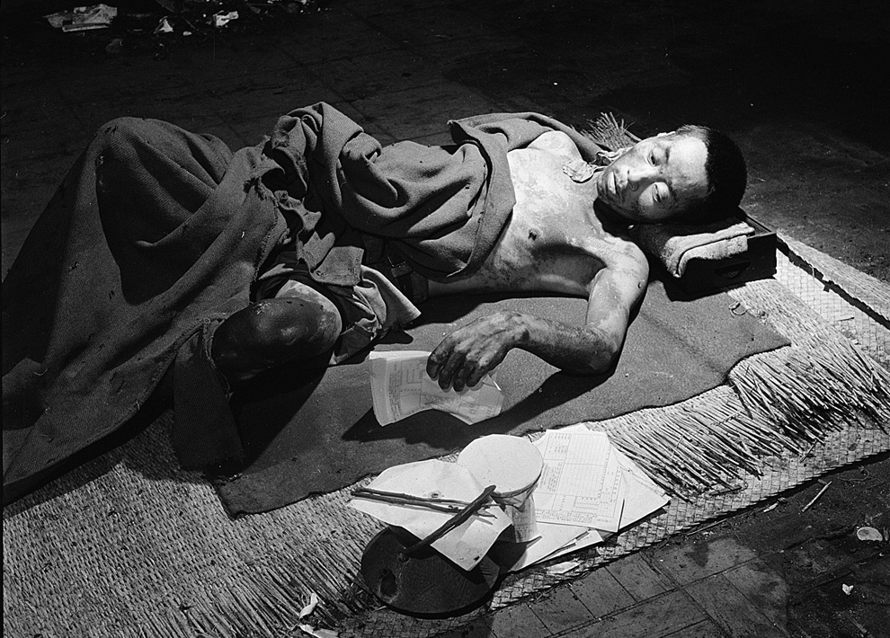 23. Жертва бомбардировки в Хиросиме лежит во временном госпитале, расположенном в одном из уцелевших зданий банка в сентябре 1945 года. (U.S. Department of Navy)