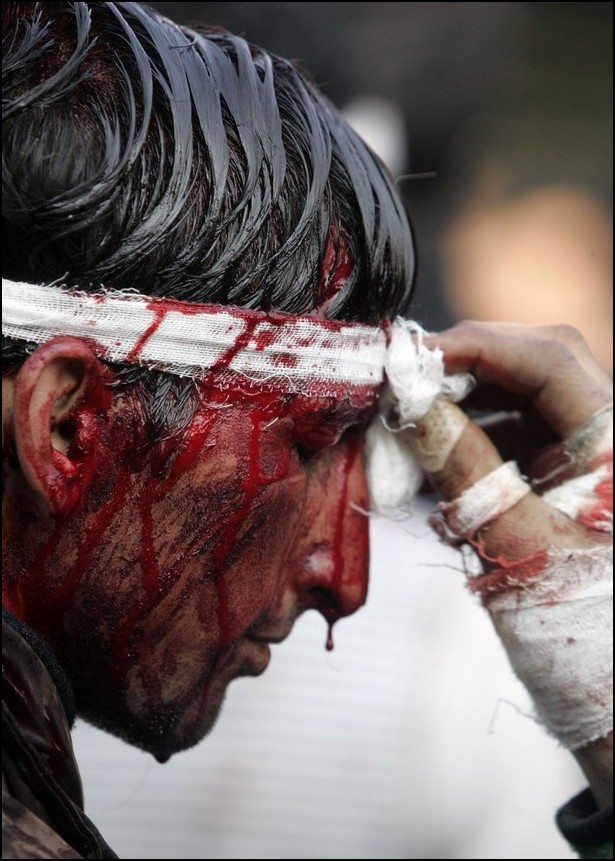 4) © Reuters / Denmark Ismail / / paramedis mencuci darah dari wajah Syiah.