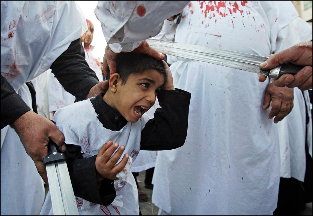 23) Karim Kadim ©, AP / / Seorang anak laki-laki dengan pedang memotong daging dari kepala.