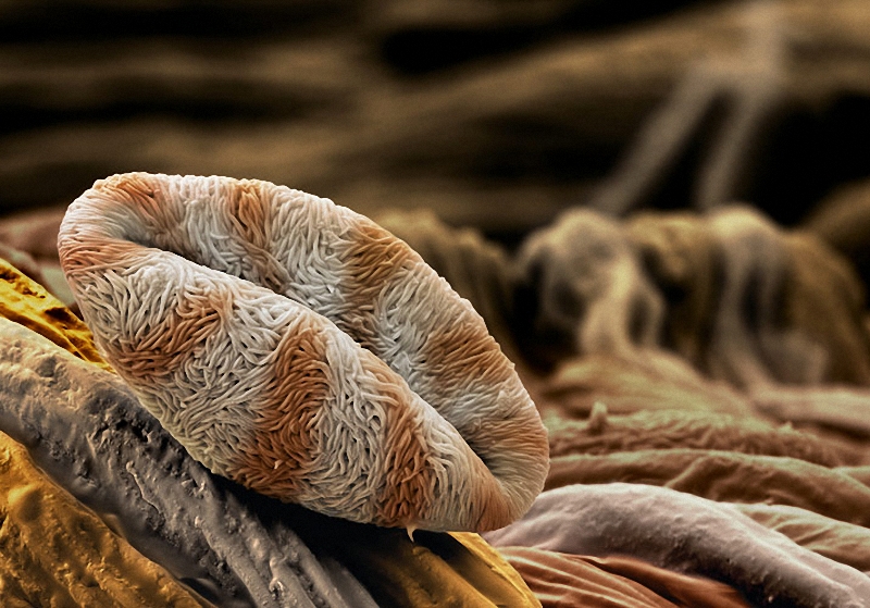 5) Благодаря извилистой поверхности пыльцы айвы (Chaenomeles), влага впитывается быстрее, когда пыльцевое зерно достигает цветка. «Чем быстрее увлажнение, тем быстрее формируется  пыльцевая трубка, - объясняет швейцарский фотограф Мартин Оггерли, научный сотрудник госпиталя Университета Базеля. – Это очень важно для оплодотворения». (Martin Oeggerli)