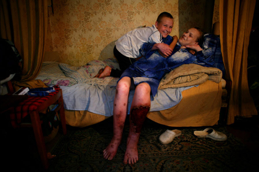 415 Украина: секс, наркомания, бедность и СПИД (Часть 1)