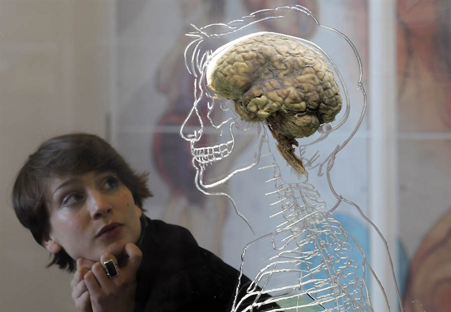 0037
 В Бристольском научном центре выставили человеческий мозг 