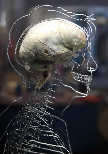 0123
 В Бристольском научном центре выставили человеческий мозг 