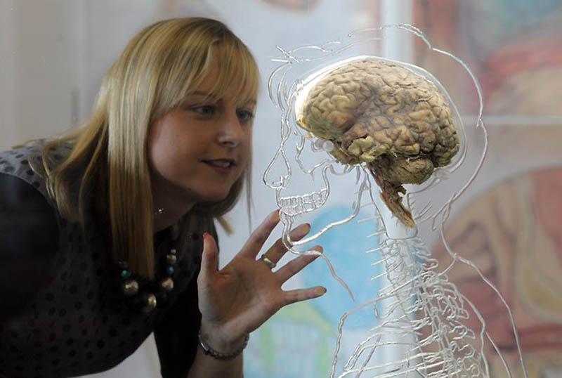 0323
 В Бристольском научном центре выставили человеческий мозг 