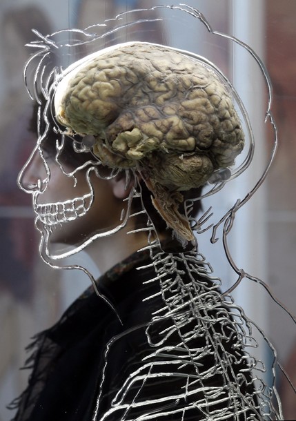 0424
 В Бристольском научном центре выставили человеческий мозг 