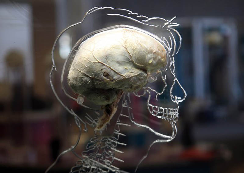 0523
 В Бристольском научном центре выставили человеческий мозг 