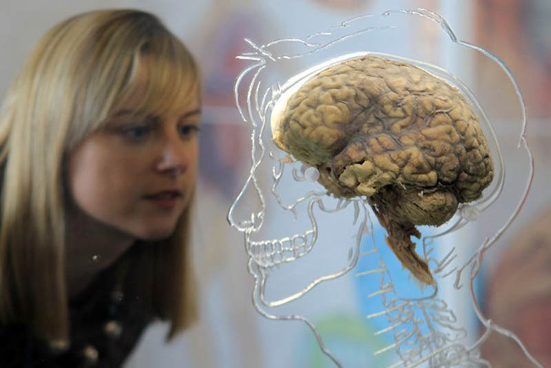 0623
 В Бристольском научном центре выставили человеческий мозг 