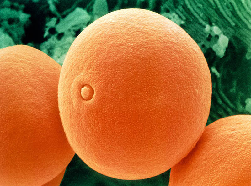 pollen10 Пыльца под микроскопом