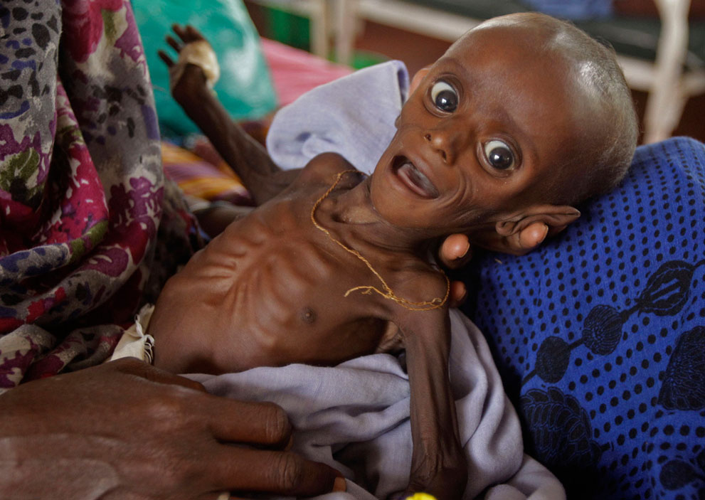 hungymamafrika01 Kelaparan di Afrika Timur