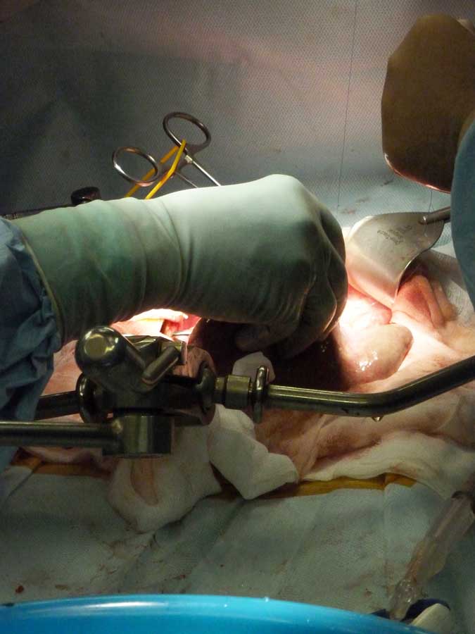 382 Один день из жизни трансплантолога