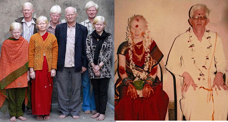 BIGPIC10 Самая большая семья альбиносов