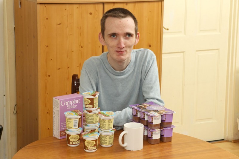 anorexic09 800x533 23 летний британец анорексик боится твердой пищи