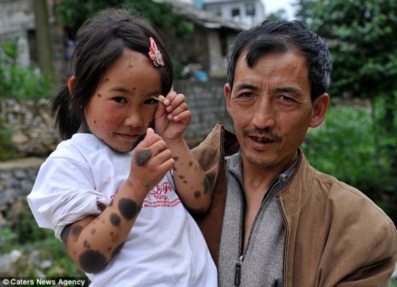 00pbhtr2 В Китае родители отказались от ребенка оборотня