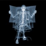 5Сидящий человек 150x150 Cамые странные рентгеновские снимки