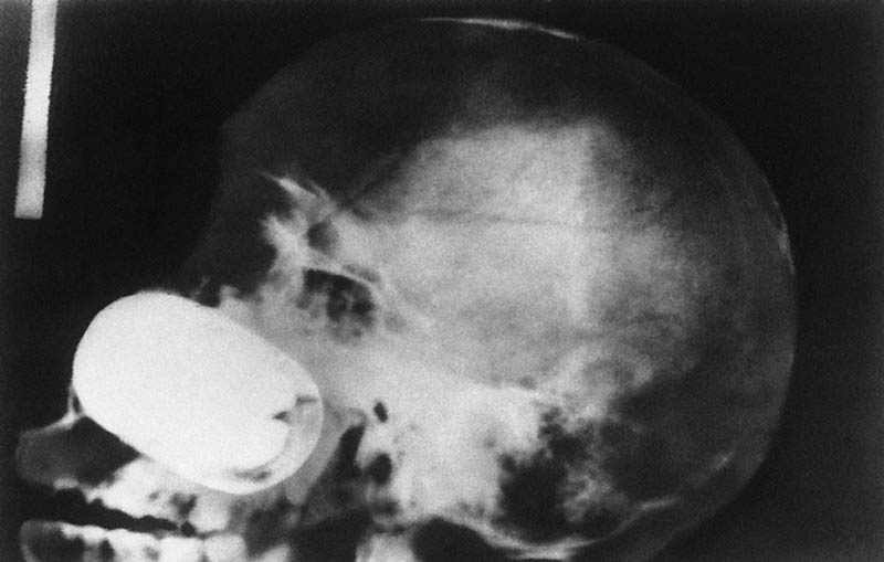 1644 Cамые странные рентгеновские снимки