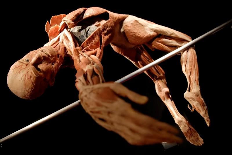 anatomy10 6 самых шокирующих анатомических музеев мира