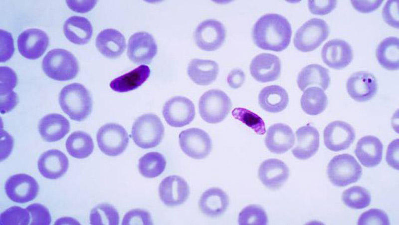parasites23 25 самых необычных и опасных паразитов