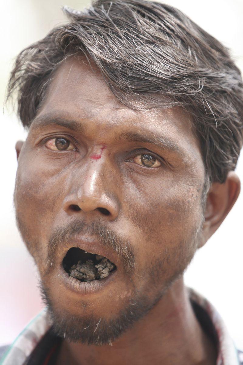 eatingrocks01 Индиец 20 лет питается кирпичами и камнями