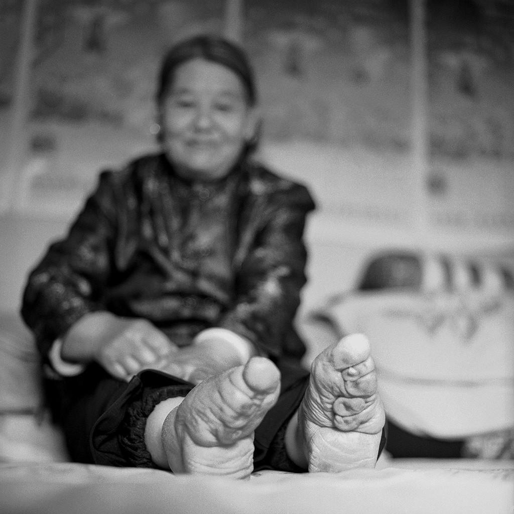 Последние живые китаянки, прошедших через страшный обычай бинтования ног