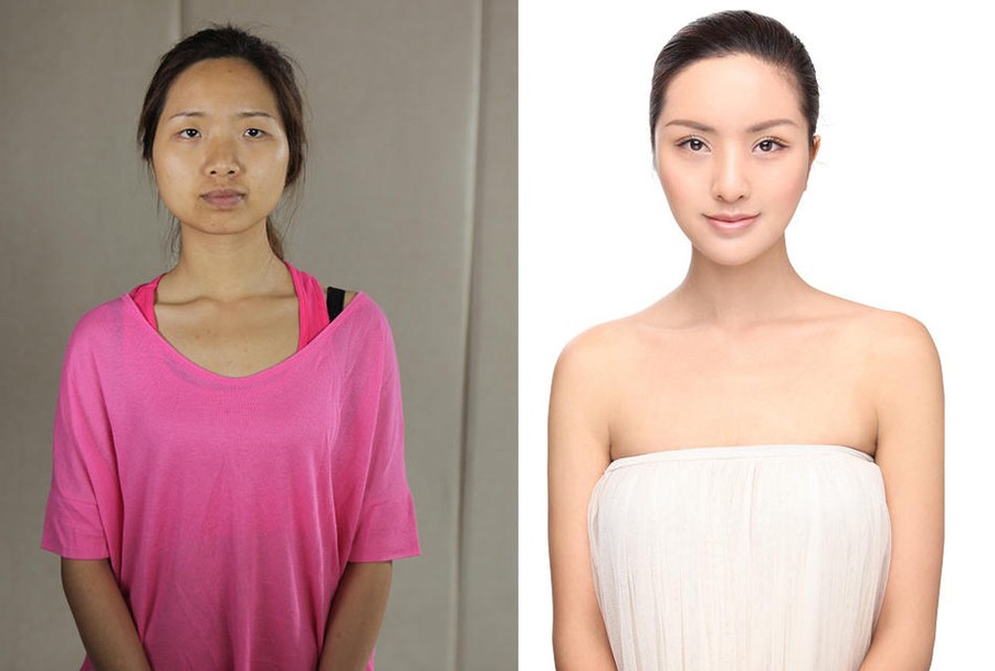 CNplastic01 Стандарты красоты: китаянки после пластики