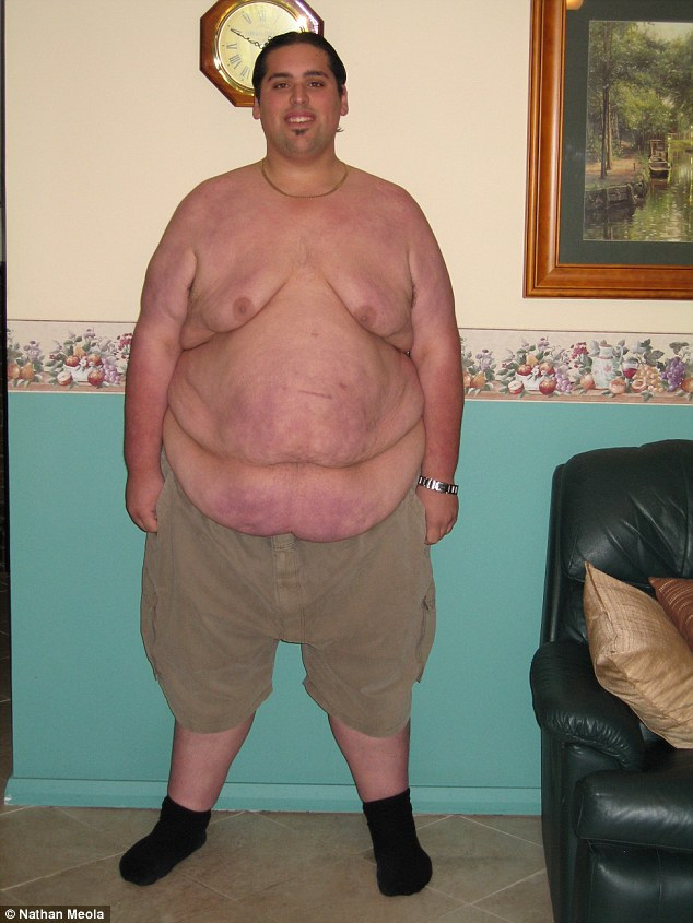 slimming01 После неудачи на телешоу The Biggest Loser парень похудел сам и стал тренером