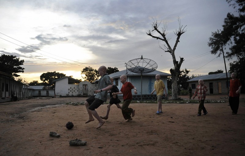 Фотография: Альбиносы в Танзании №5 - BigPicture.ru