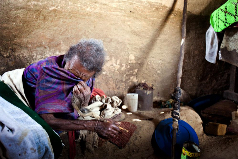 Фотография: Деревня прокаженных в Эфиопии №16 - BigPicture.ru