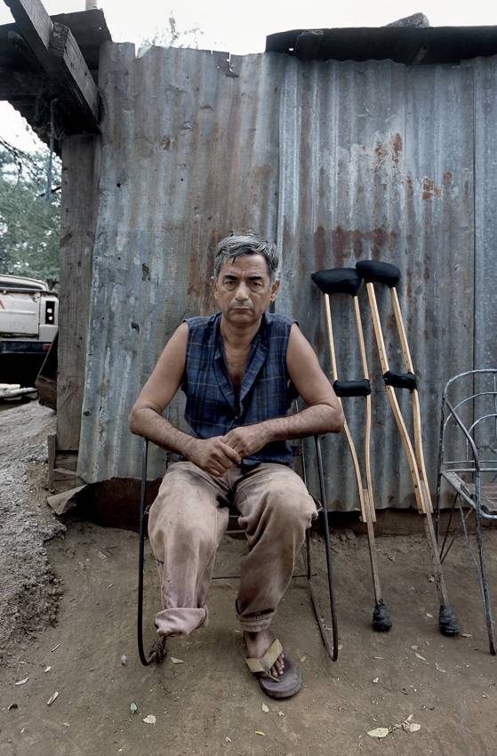 Фотография: Жизнь инвалидов в Никарагуа №11 - BigPicture.ru