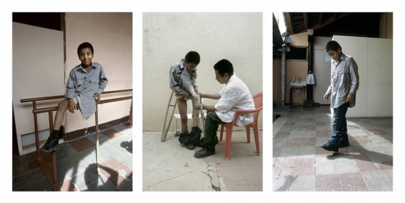 Фотография: Жизнь инвалидов в Никарагуа №1 - BigPicture.ru