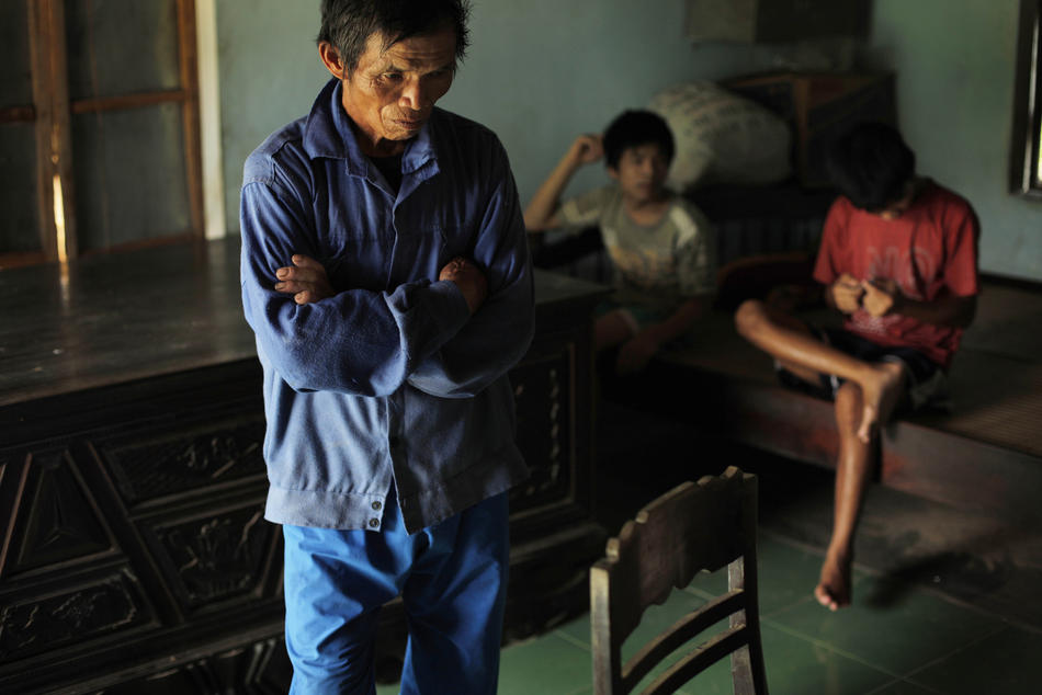 Фотография: Жертвы Агента Оранж во Вьетнаме №3 - BigPicture.ru