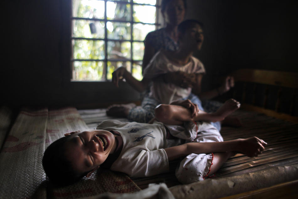 Фотография: Жертвы Агента Оранж во Вьетнаме №5 - BigPicture.ru