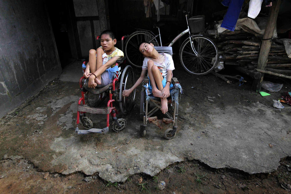 Фотография: Жертвы Агента Оранж во Вьетнаме №6 - BigPicture.ru