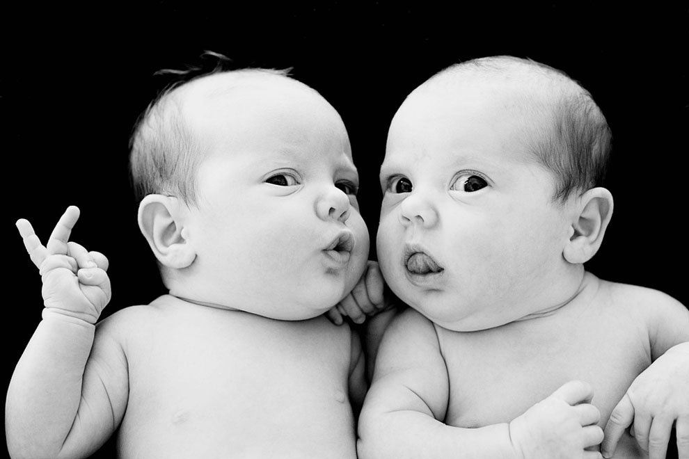 Фотография: 20 фактов о близнецах, которые вас удивят №18 - BigPicture.ru