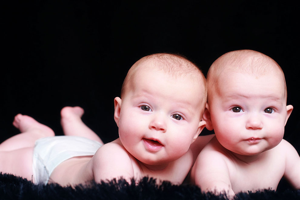 Фотография: 20 фактов о близнецах, которые вас удивят №16 - BigPicture.ru