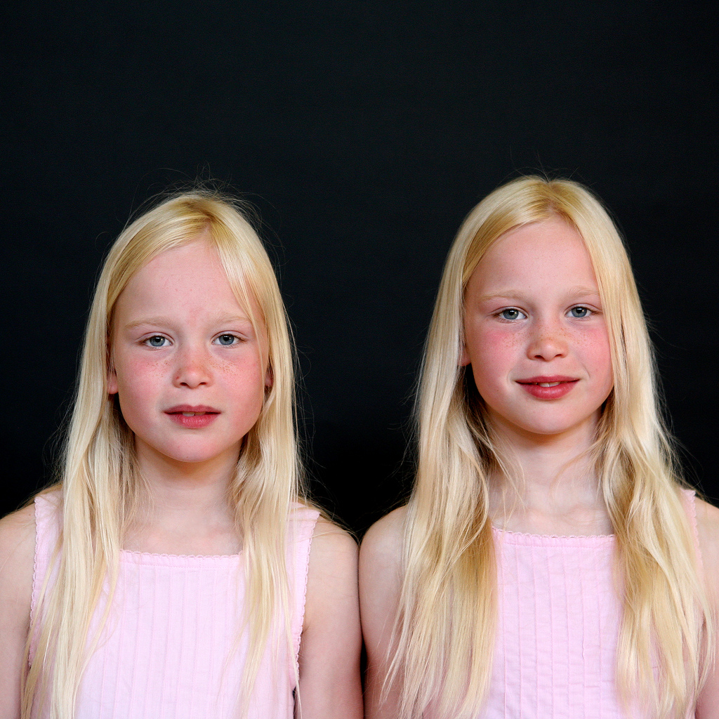 Фотография: 20 фактов о близнецах, которые вас удивят №12 - BigPicture.ru
