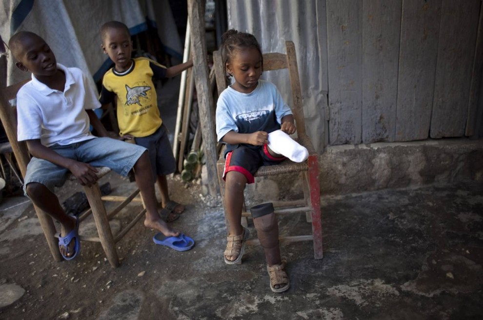 Фотография: Маленький инвалид с Гаити №5 - BigPicture.ru
