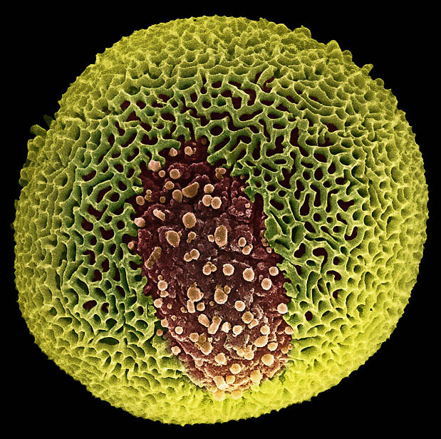 Фотография: Пыльца под микроскопом №7 - BigPicture.ru
