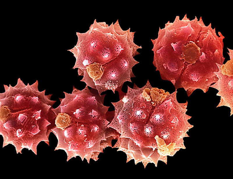 Пыльца в моче фото под микроскопом