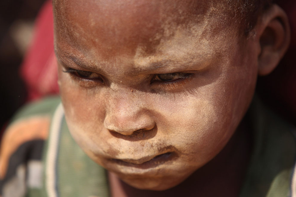 Фотография: Голод в Восточной Африке №16 - BigPicture.ru