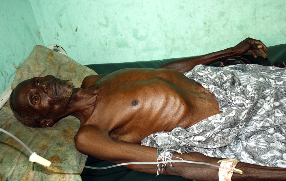 Фотография: Голод в Восточной Африке №18 - BigPicture.ru