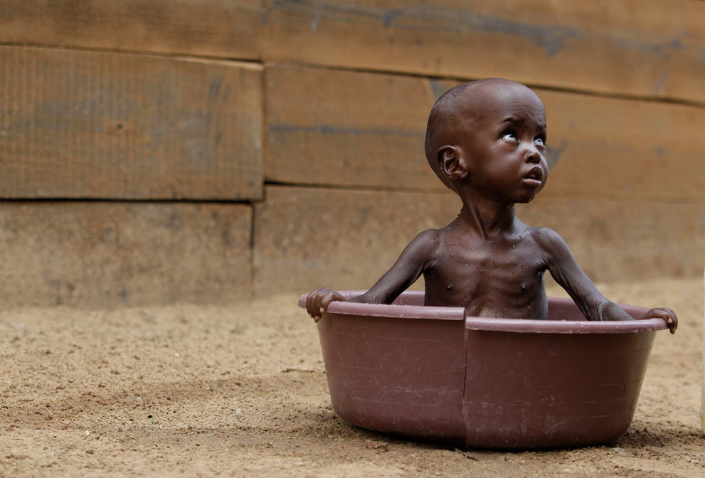 Фотография: Голод в Восточной Африке №27 - BigPicture.ru