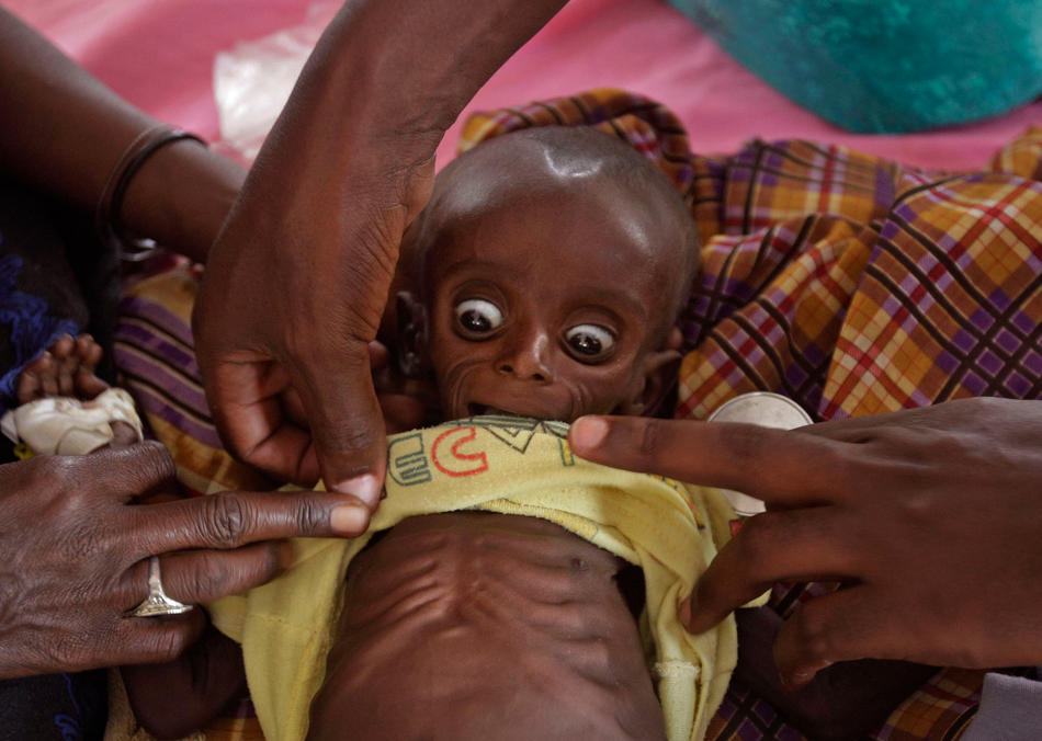 Фотография: Голод в Восточной Африке продолжается №29 - BigPicture.ru