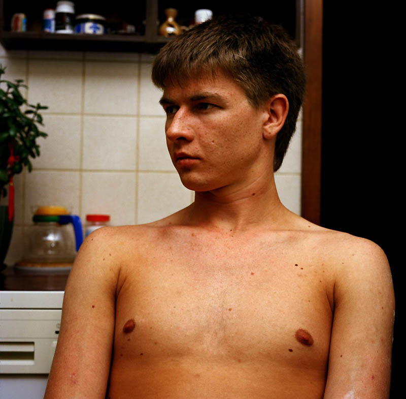 Фотография: Ника: Жизнь со СПИДом №28 - BigPicture.ru