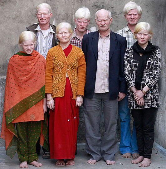Фотография: Самая большая семья альбиносов №2 - BigPicture.ru