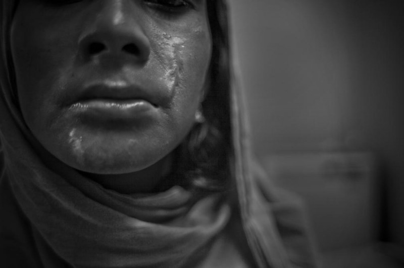 Фотография: Воспитание кислотой в Бангладеш №1 - BigPicture.ru