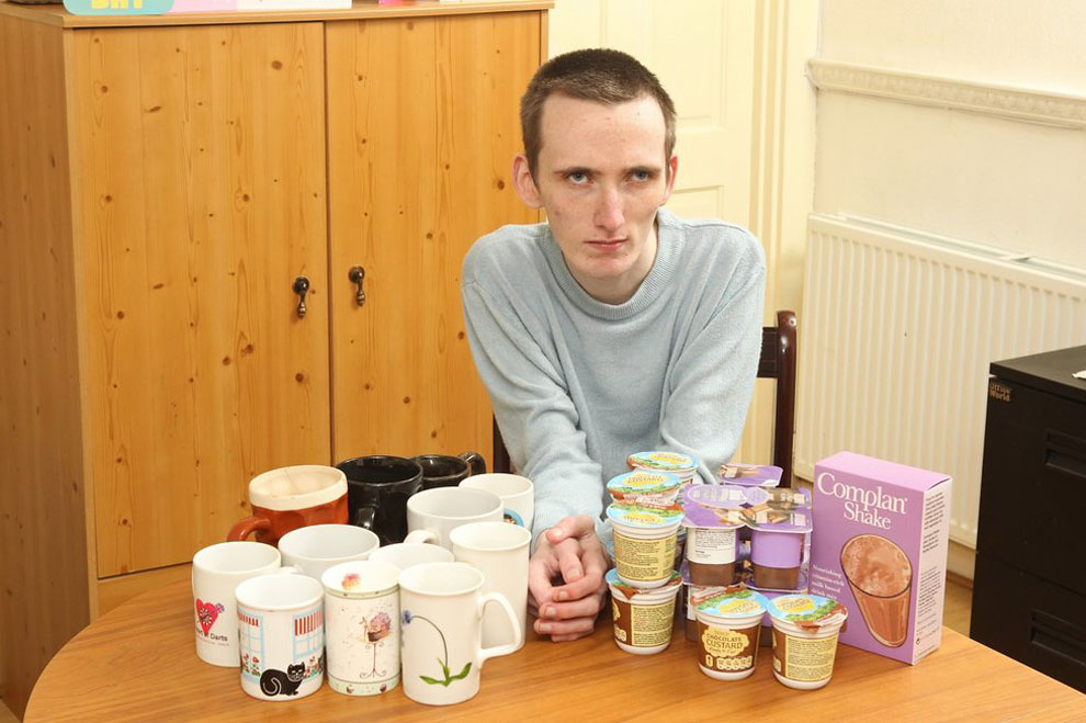 Фотография: 23-летний британец-анорексик боится твердой пищи №3 - BigPicture.ru