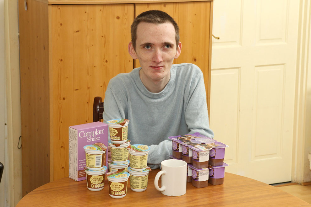 Фотография: 23-летний британец-анорексик боится твердой пищи №10 - BigPicture.ru