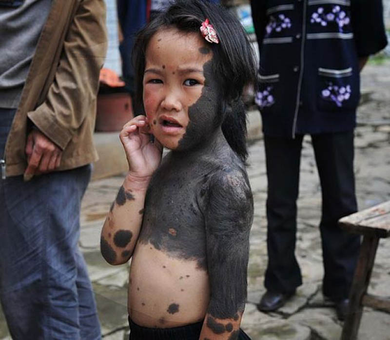Фотография: В Китае родители отказались от ребенка-оборотня №7 - BigPicture.ru